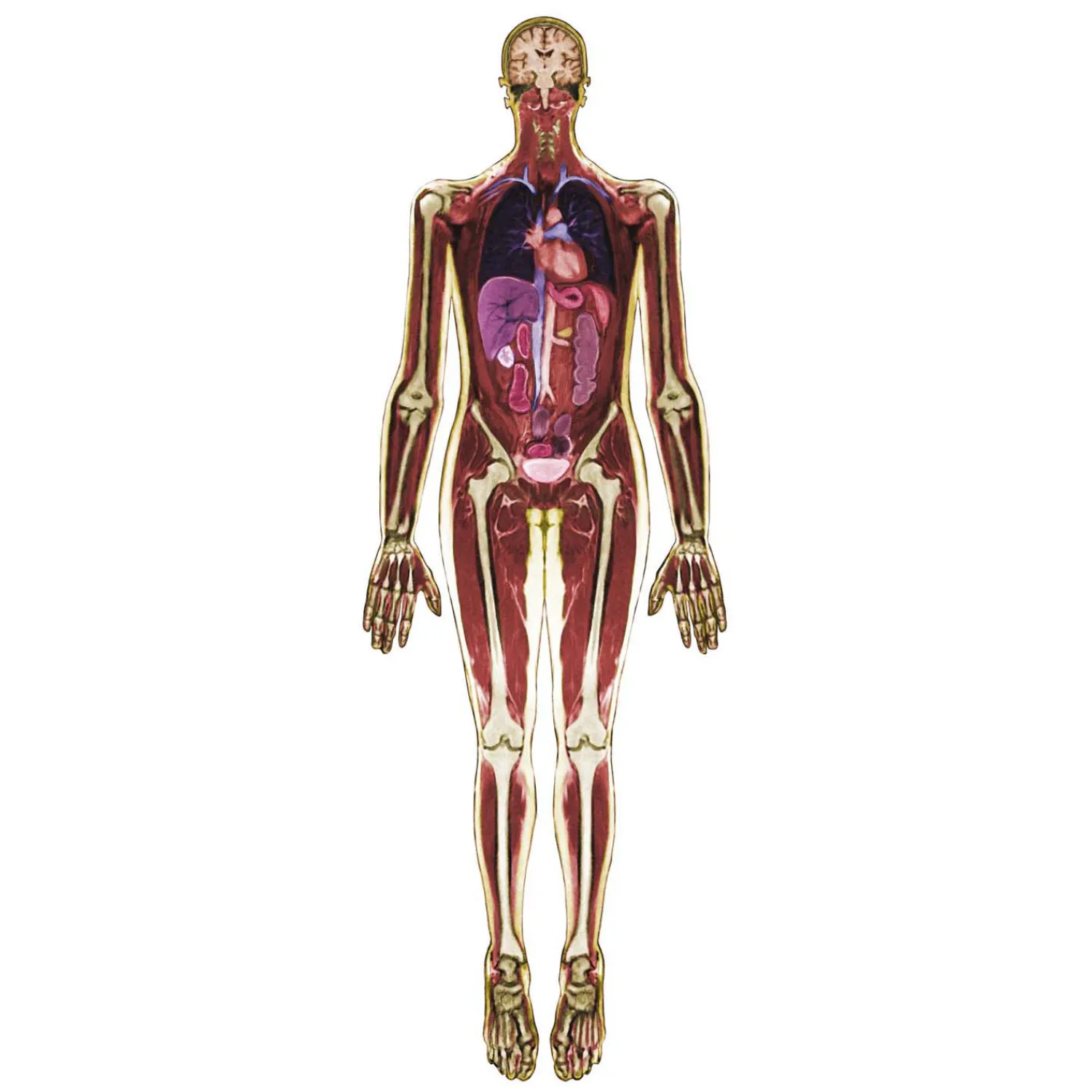 MRI-Scan Lichaam - 3dlg.> Sale